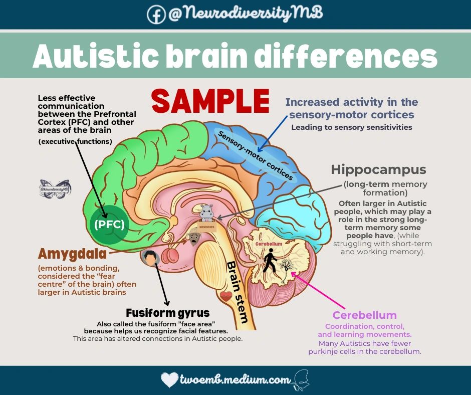 Autistic brain differences
